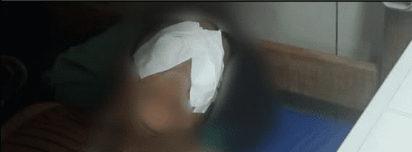 Leia mais sobre o artigo Servidora do Hospital Walfredo Gurgel sofre queimadura química nos olhos após exposição a produtos tóxicos usado pela Sesap 