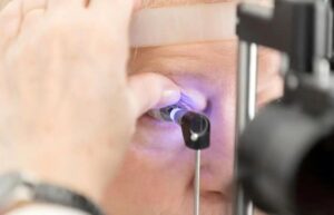 Leia mais sobre o artigo Transplante de córnea: 33 mil pessoas aguardam cirurgia no Brasil