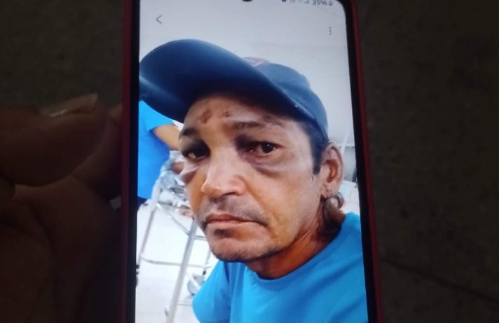 No momento, você está visualizando Paciente com traumatismo craniano some do Walfredo Gurgel e morre na rua; família exige respostas