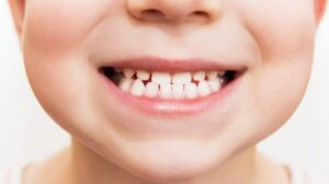 Leia mais sobre o artigo Prevenção odontológica em oncologia pediátrica