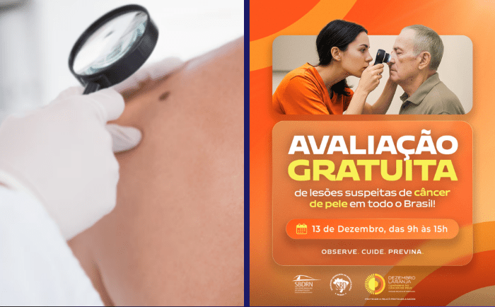 Leia mais sobre o artigo Campanha “Dezembro Laranja” traz ações de prevenção ao câncer de pele e atendimento gratuito à população