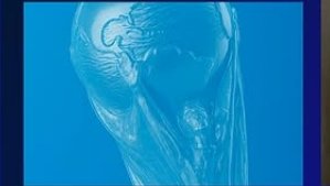 Leia mais sobre o artigo Copa 2026: Brasil cai em chave com Marrocos, Escócia e Haiti