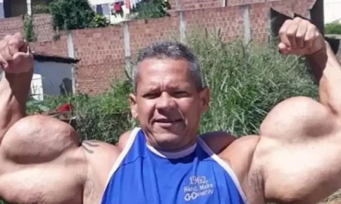 Leia mais sobre o artigo Morre Arlindo de Souza, conhecido como “Popeye Brasileiro”