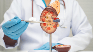 Leia mais sobre o artigo Hospital Universitário Onofre Lopes alerta para os sinais silenciosos das doenças renais e destaca avanços em pesquisas