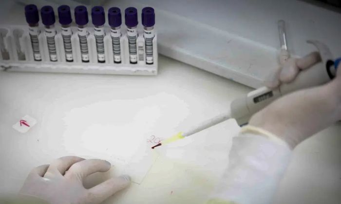 Leia mais sobre o artigo Paciente em SP com suspeita de ebola testa positivo para meningite