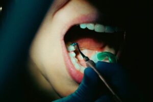 Leia mais sobre o artigo Justiça condena empresa de ônibus por acidente que causou perda de dentes em idosa