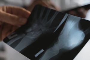 Leia mais sobre o artigo Erro médico em atendimento a criança leva à condenação de município por danos morais