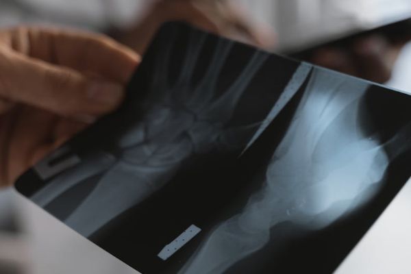 Leia mais sobre o artigo Erro médico em atendimento a criança leva à condenação de município por danos morais