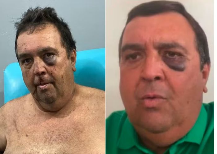 Leia mais sobre o artigo Vereador é agredido e amarrado em sequestro relâmpago no interior do RN