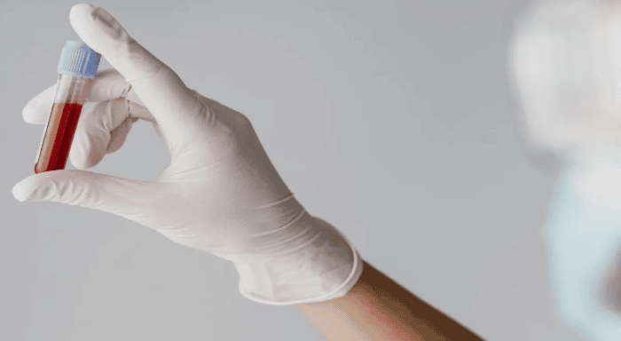 No momento, voc&ecirc; est&aacute; visualizando Leucemia: os sinais que n&atilde;o podem ser ignorados